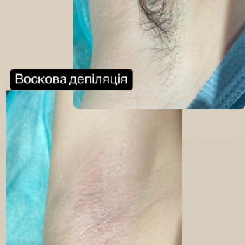 Maryna Хижняк, Szczecin Фото - 5