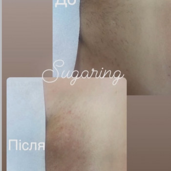 Maryna Хижняк, Szczecin Фото - 6