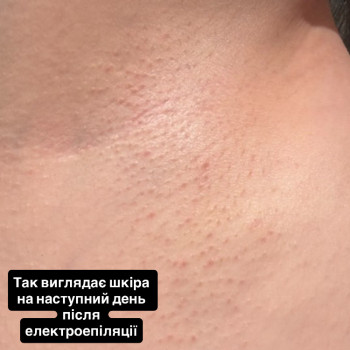 Maryna Хижняк, Szczecin Фото - 9