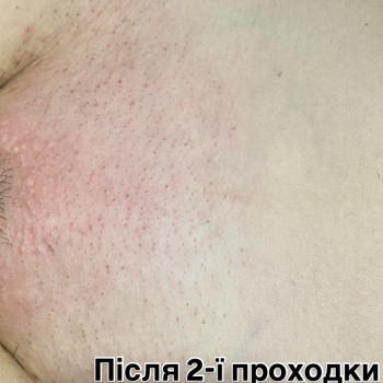 Maryna Хижняк, Szczecin Фото - 10