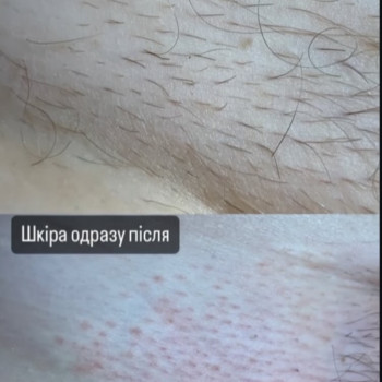 Maryna Хижняк, Szczecin Фото - 16