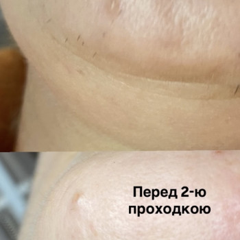 Maryna Хижняк, Szczecin Фото - 17