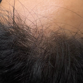 Трихопигментация