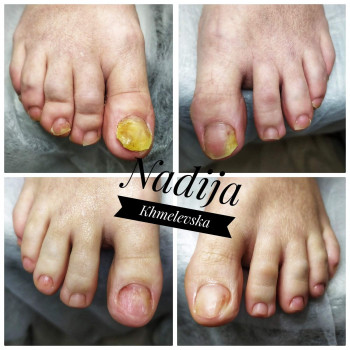 Nadiia Khmelevska, Krakow Фото - 6