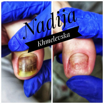 Nadiia Khmelevska, Krakow Фото - 7