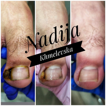 Nadiia Khmelevska, Krakow Фото - 8