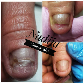 Nadiia Khmelevska, Krakow Фото - 9