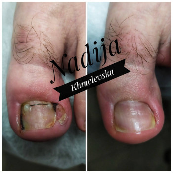 Nadiia Khmelevska, Krakow Фото - 10