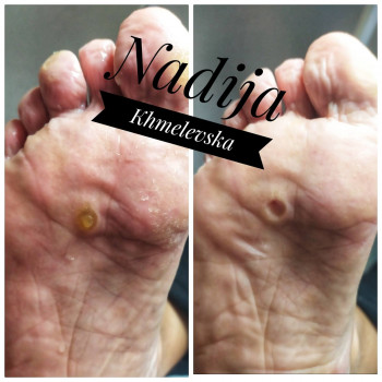 Nadiia Khmelevska, Krakow Фото - 11