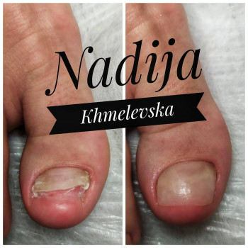 Nadiia Khmelevska, Krakow Фото - 12