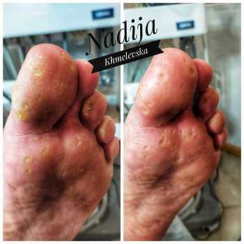 Nadiia Khmelevska, Krakow Фото - 13