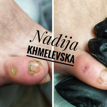 Nadiia Khmelevska, Krakow Фото - 15
