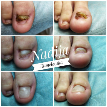 Nadiia Khmelevska, Krakow Фото - 17