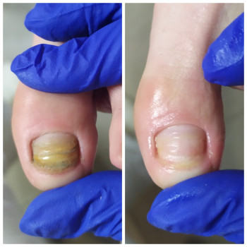 Nadiia Khmelevska, Krakow Фото - 18