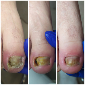 Nadiia Khmelevska, Krakow Фото - 19