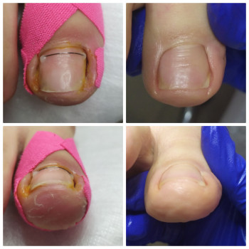 Nadiia Khmelevska, Krakow Фото - 20