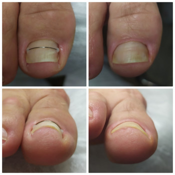 Nadiia Khmelevska, Krakow Фото - 21