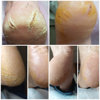 Nadiia Khmelevska, Krakow Фото - 22