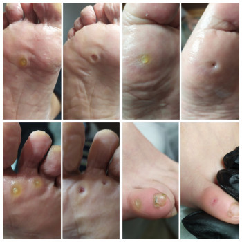 Nadiia Khmelevska, Krakow Фото - 23