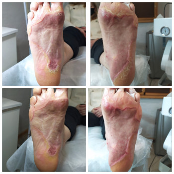 Nadiia Khmelevska, Krakow Фото - 24