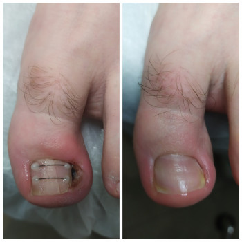 Nadiia Khmelevska, Krakow Фото - 25