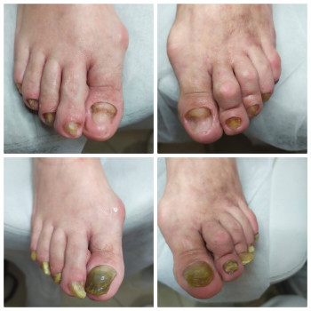 Nadiia Khmelevska, Krakow Фото - 26