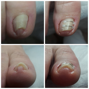 Nadiia Khmelevska, Krakow Фото - 27