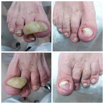 Nadiia Khmelevska, Krakow Фото - 28