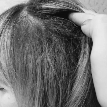 Прикорневой обьем