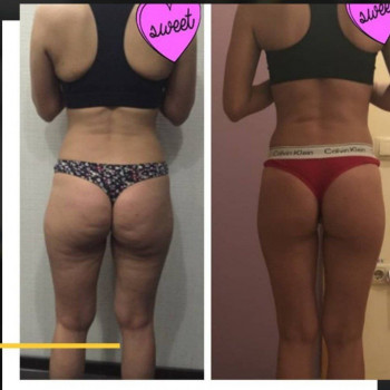 Персональная тренировка: похудение и здоровая спина