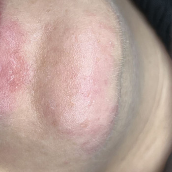 Iryna Krylova, Wroclaw Фото - 10