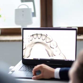 We are waiting for u!