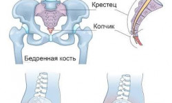 Лечение кокцигодинии - боль в копчике Мануальный терапевт, гирудотерапевт, иглотерапевт, Ален Ахшатаев Алматы