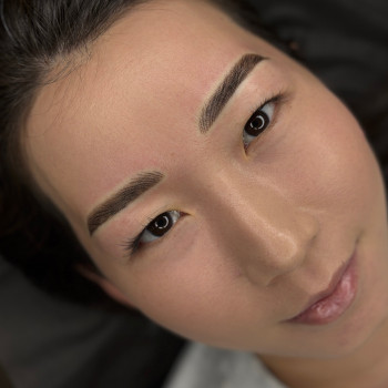Laser Tattoo Removal